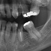 dentistry holly springs