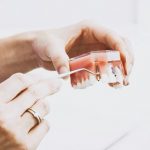 What are dentures made of?