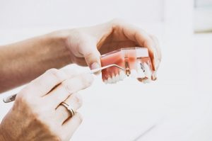 What are dentures made of?