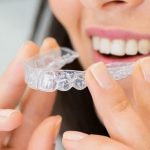 invisalign FAQs Cary cosmetic dentists