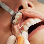 tips to stop grinding your teeth
