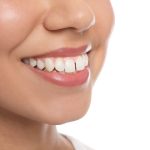 how to fix an overbite with help from your dentist