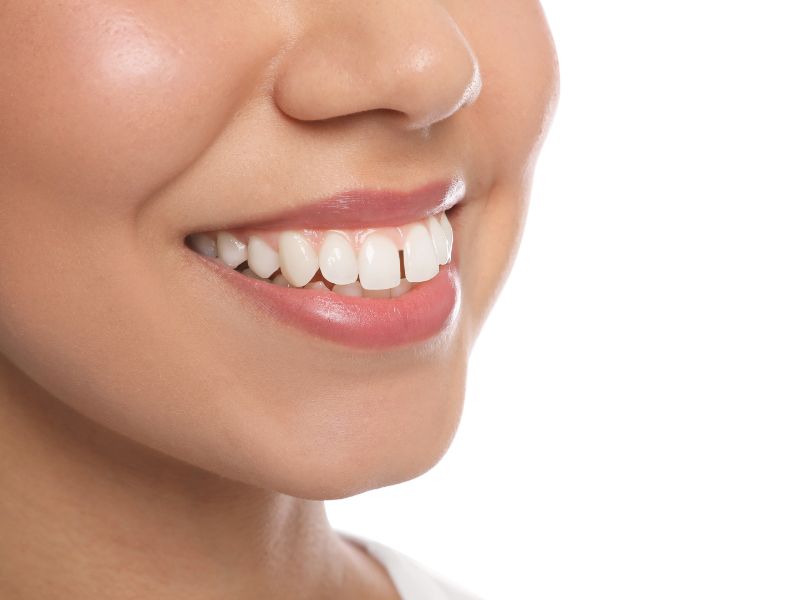 How to Fix an Overbite with Help From Your Dentist